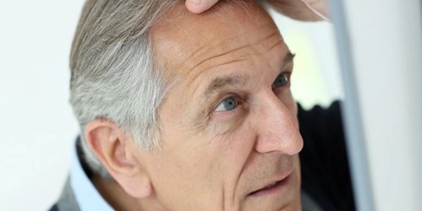 Shedding | Thinning | Training | NC Hair Loss Center